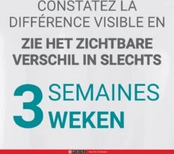 Purina One Sensitive - Kalkoen/Rijst - Kattenvoer - 800 G -Kattenbenodigdheden Winkel 1200x1063